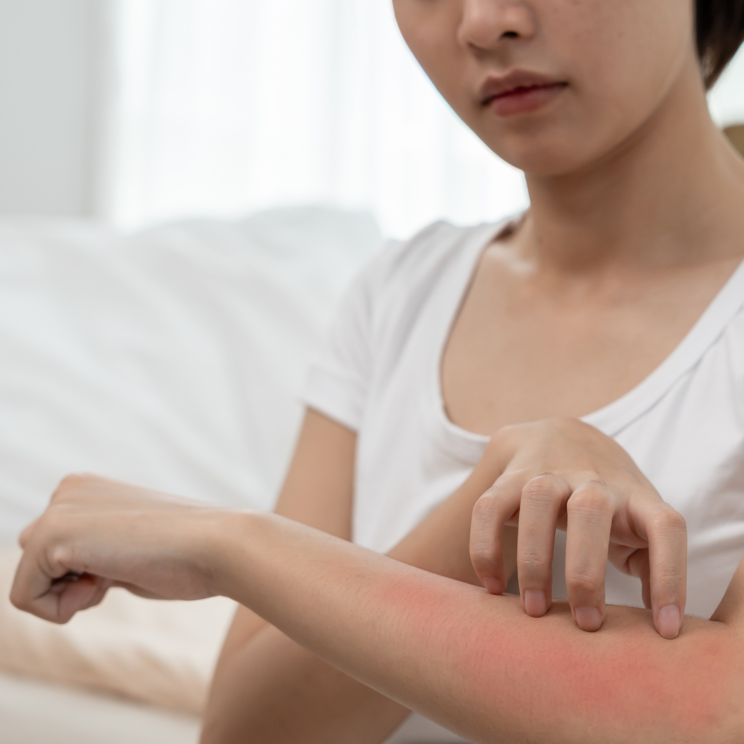 Why More Malaysians with Ezcema and Psoriasis Are Switching to Fragrance-Free Skincare