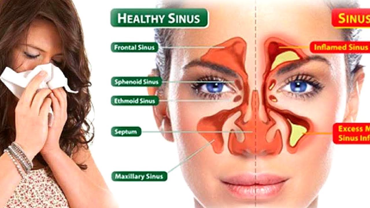 Essential Oils for Sinus Relief: Breathe Better Naturally with Yein&Young  Essential Oils